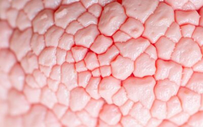 Câine carcinom scuamos – Tot ce trebuie să știi despre asta!